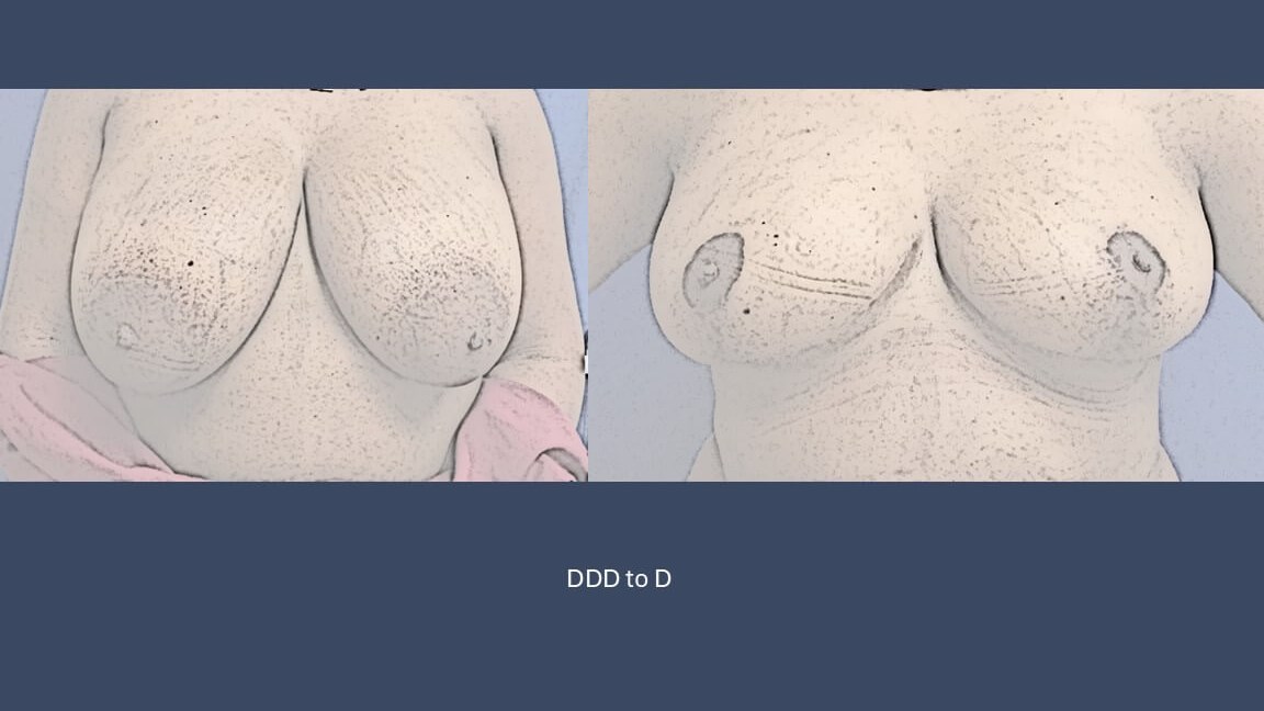 Dr Suzman Plastic Surgeon Brea